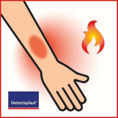 Het Burn Care gamma van Detectaplast, eerste hulp bij brandwonden